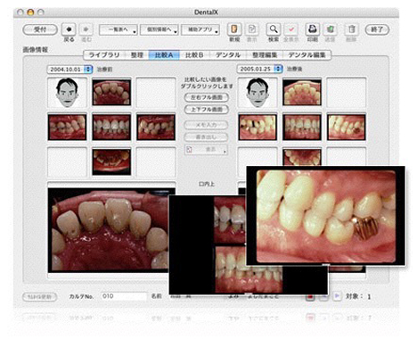 DENTAL X