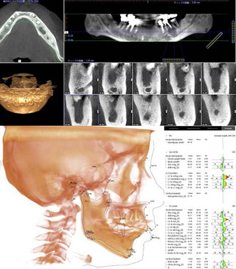 Invivo 5